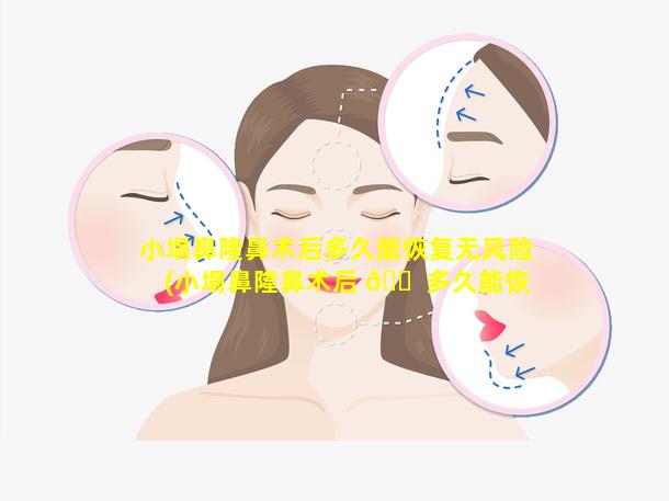 小塌鼻隆鼻术后多久能恢复无风险(小塌鼻隆鼻术后 🐠 多久能恢复无风险状态)